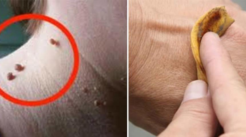 Muz Kabuğuyla Sadece 1 Haftada Çözebileceğiniz  6 Problem