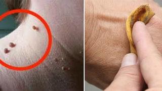 Muz Kabuğuyla Sadece 1 Haftada Çözebileceğiniz  6 Problem