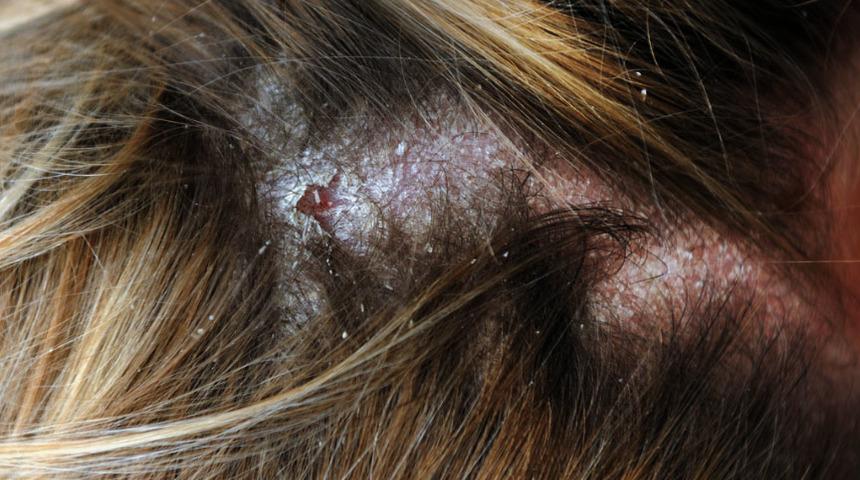 Saçınızın size sağlığınız hakkında anlatabileceği 8 şey! Geçer diye ihmal ederseniz...