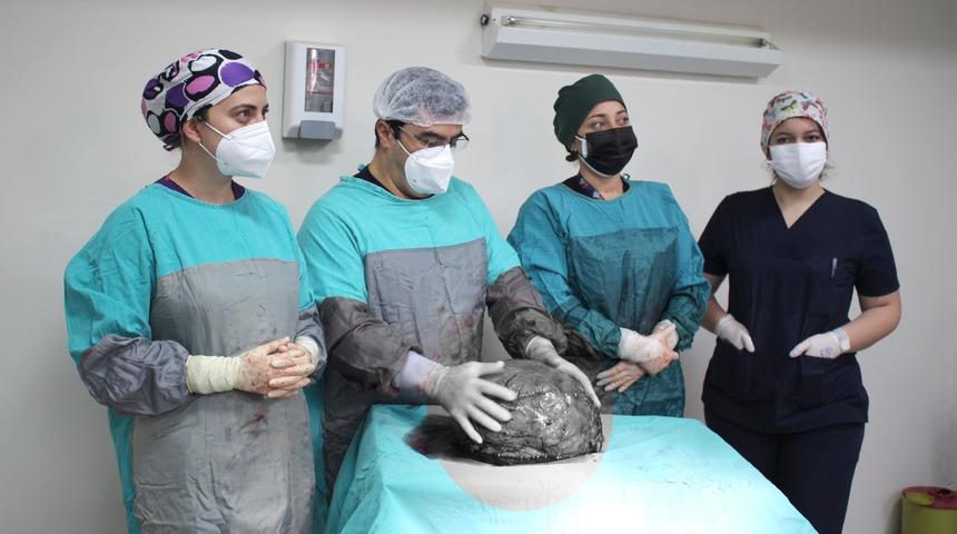 Gaz şikayetiyle gittiği hastanede karnından 9 kilo tümör çıkarıldı