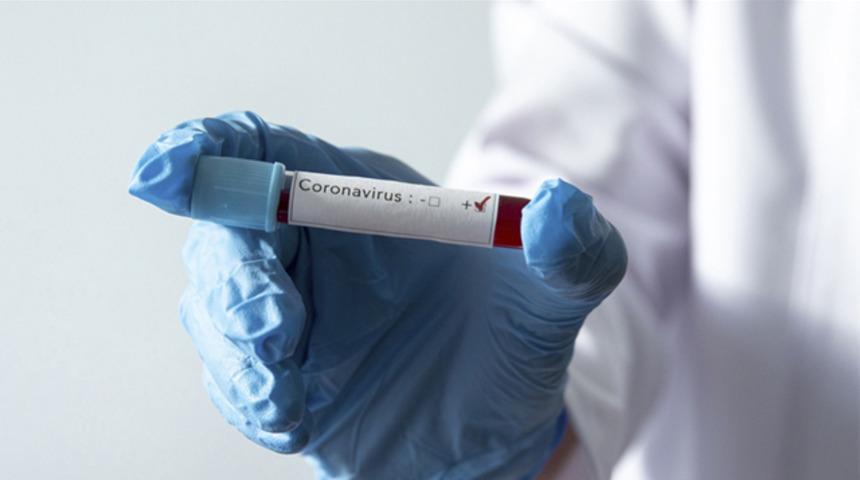 Hatayspor'da Galatasaray maçı öncesi koronavirüs şoku