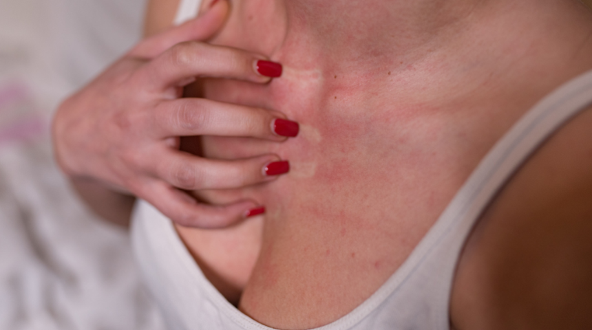 Göğüslerinizin ucu ve göğsünüz kaşınıyorsa nedeni bu olabilir