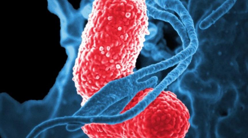 Zatürre neden olur ve nasıl geçer? Zatürre belirtileri ve tedavi yöntemleri nelerdir? Zatürre bulaşıcı mıdır?