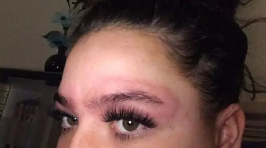 Aman dikkat! Kaş boyası kabusu oldu, yüzü 'davul' gibi şişti