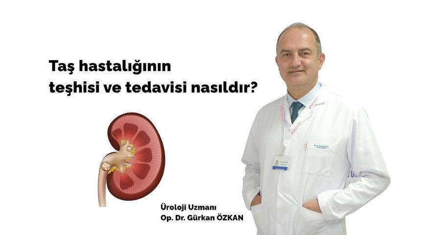 Taş hastalığına ses dalgası ve lazer &ccedil;&ouml;z&uuml;m&uuml;