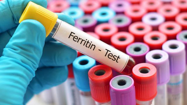 Ferritin nedir? Ferritin değeri kaç olmalıdır? Düşüklüğü ile yükseliği nedenleri ve belirtileri