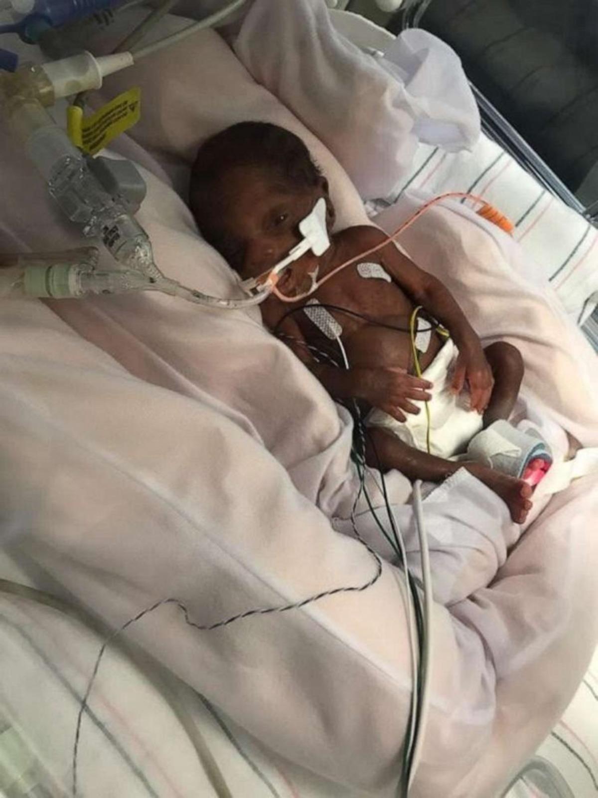 450 gram doğmuştu, mezuniyet belgesi aldı!