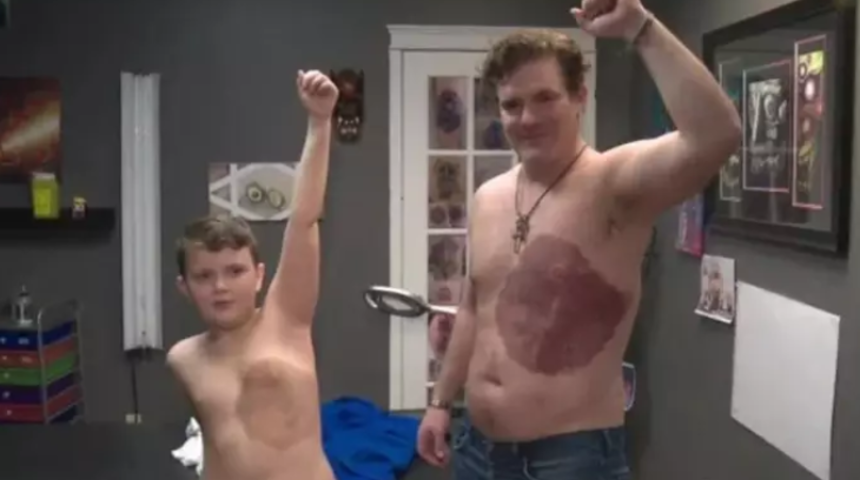 30 saat s&uuml;rd&uuml;! Oğlunun doğum lekesini d&ouml;vme yaptırana adam...