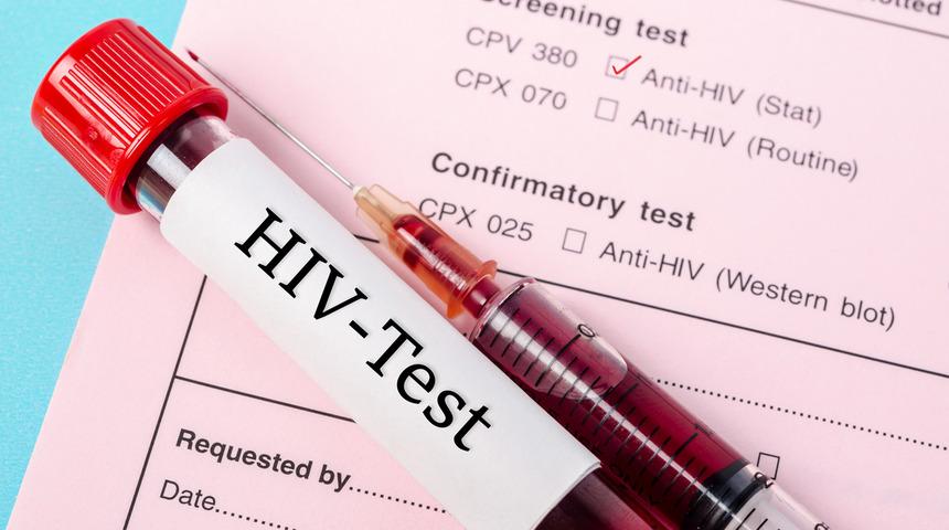 HIV virüsü nedir?