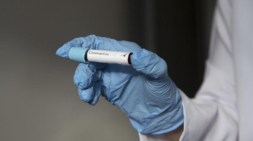 Gençlerbirliği'nde 1 futbolcunun Kovid-19 testi pozitif 