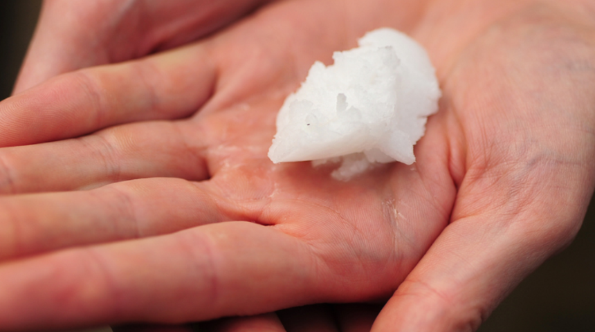 Ev yapımı şifalı krem! Yaraları ve izleri anında yok ediyor