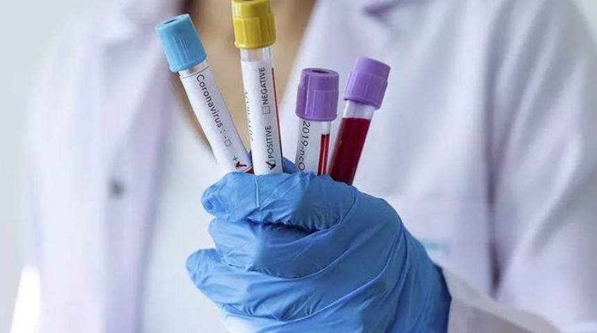 DSÖ: Dünya genelinde dün her 100 dakikada bir 25 bin yeni vaka rapor edildi