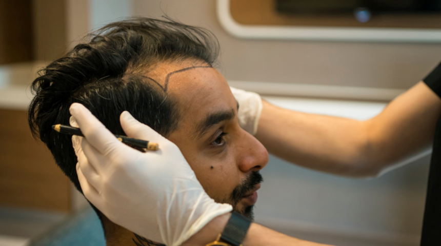 Saç ekimine destek uygulamalar nelerdir?