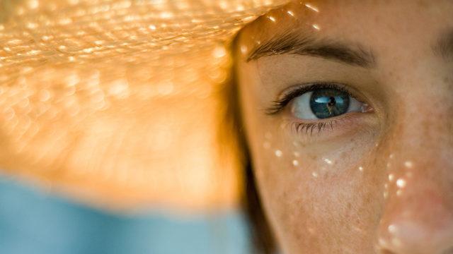 Güneş lekelerine ne iyi gelir? Yüzdeki güneş lekelerini yok eden evde uygulanacak doğal yöntemler