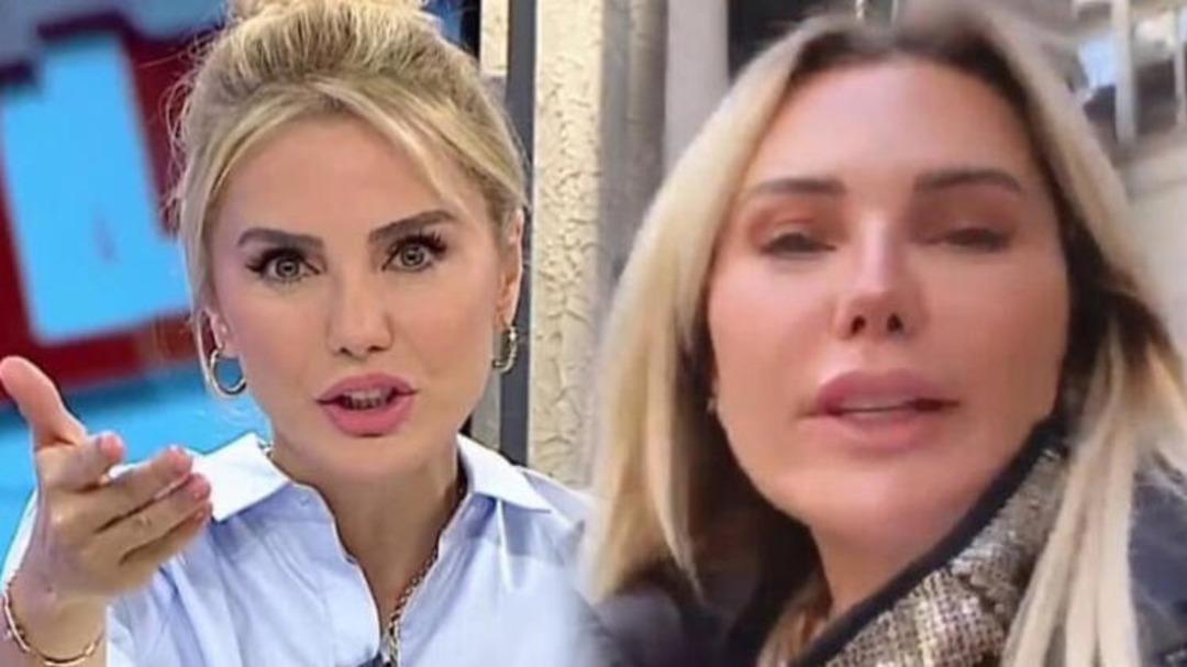 Ece Erken şaşkına &ccedil;evirdi! Estetik kurbanı mı? 