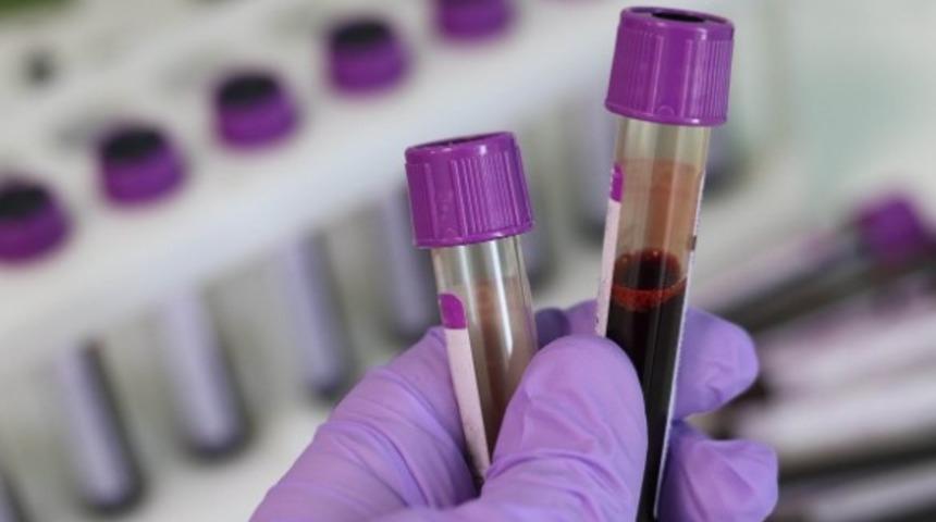 CRP nedir? CRP neden yükselir?