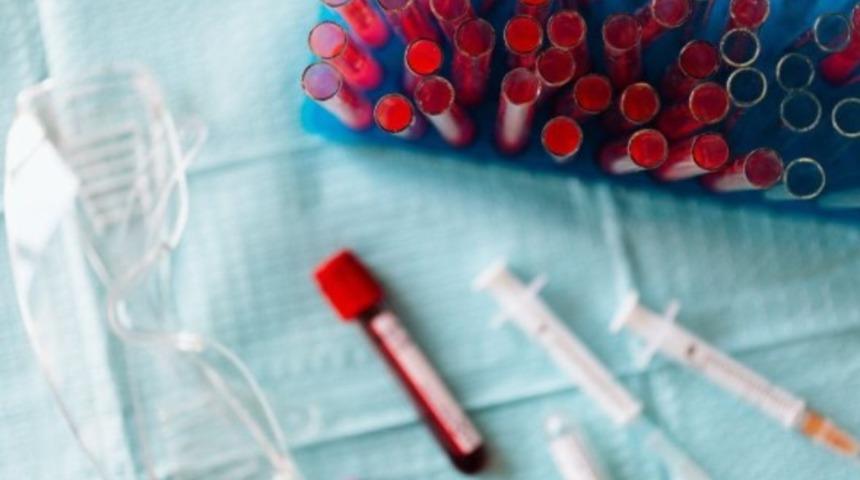 Antikor testi nedir? Antikor testi neden yapılır?