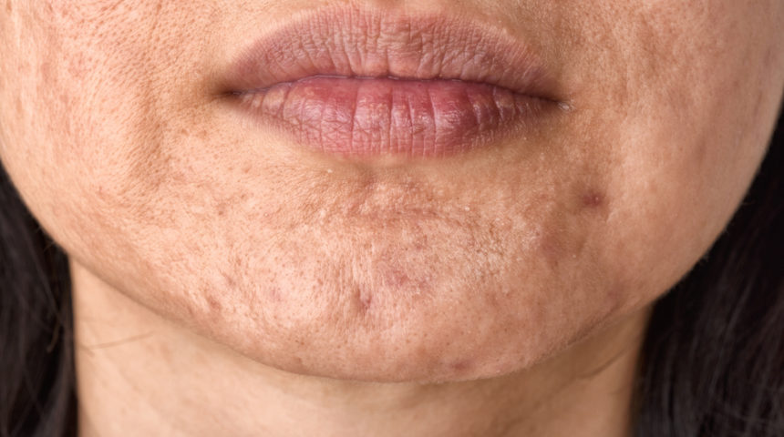 Sihirli bir değnek gibi! &Uuml;nl&uuml;ler bu sayede kusursuz g&ouml;r&uuml;n&uuml;yor! G&ouml;z altı morlukları ve kırmızı lekeler i&ccedil;in...