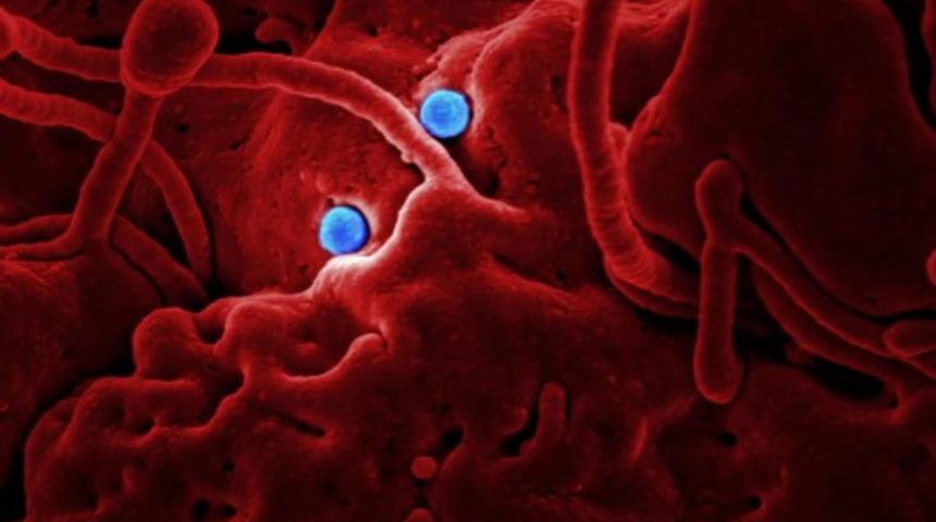 Karaciğer istilası: Hepatit B nedir? 