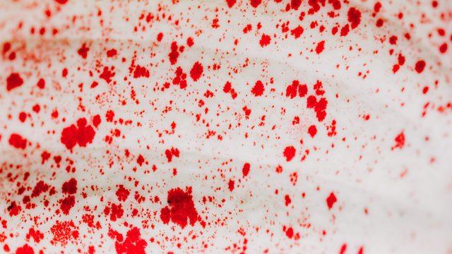 Rüyada kan kusmak ne anlama gelir? Rüyada siyah, koyu, katı, mor kan kusmak ne demek?