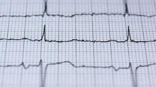 Çocukluk çağında üfürüme dikkat: Kalp üfürüm belirtileri nelerdir?