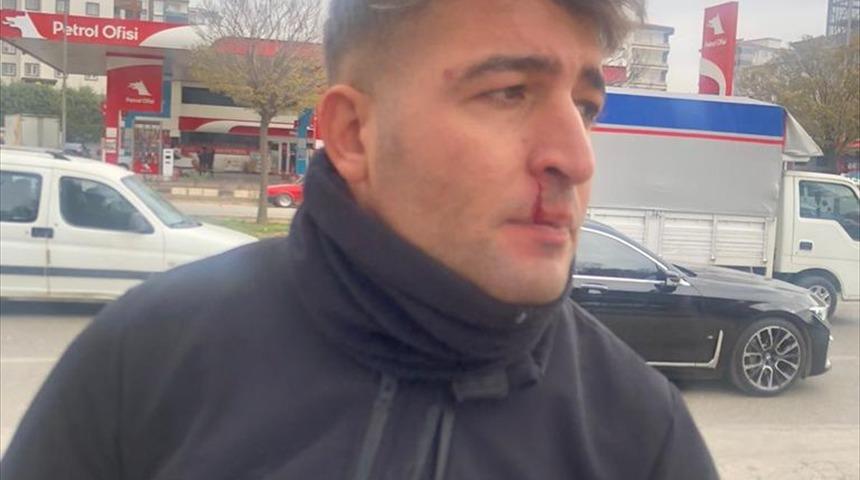 Gaziantep'te zabıtaya bı&ccedil;aklı saldırı: 2 yaralı