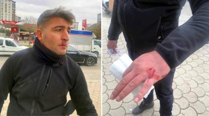Gaziantep'te zabıtalara bı&ccedil;ak ve sopalı saldırı: 2 yaralı
