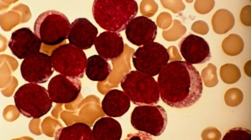 'Kök hücre' ile takma dişe veda