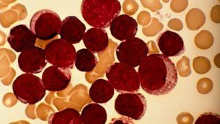 Kök hücre yerine yetişkin hücre