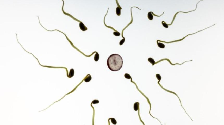 Vazektomi nedir? Vazektominin yan etkileri nelerdir?