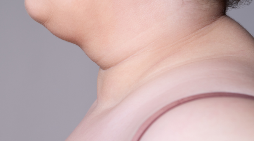 Yağ tabakasına son! Gıdı eritme hareketleriyle sarkık görüntüye son veriyoruz