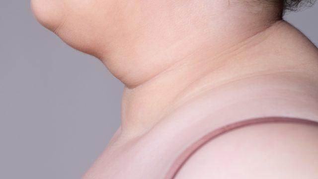 Yağ tabakasına son! Gıdı eritme hareketleriyle sarkık görüntüye son veriyoruz