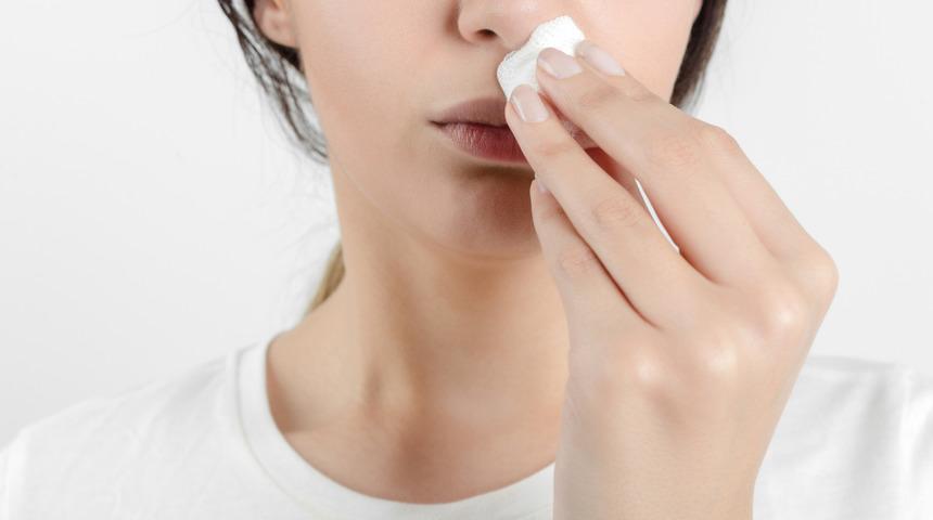 Burun kanaması neden olur? Burun kanamasını geçirme yöntemleri nelerdir?