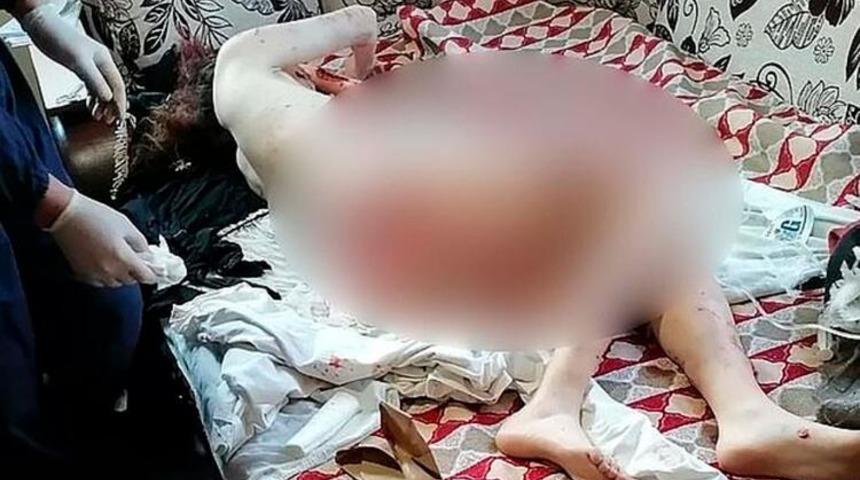 Korkunç halde bulundu! Yüzünde sadece gözleri kalmış