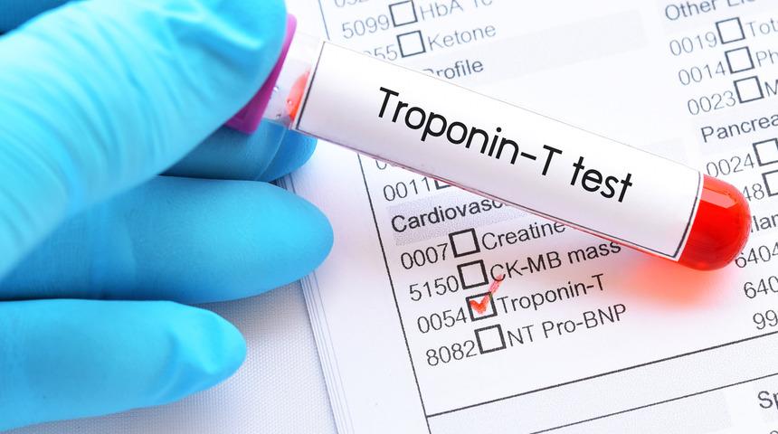 Troponin nedir, Troponin değerinin yükselmesine neler sebep olur?