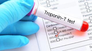 Troponin nedir, Troponin değerinin yükselmesine neler sebep olur?