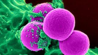 Hücrelerin duyu organları: Reseptör nedir?