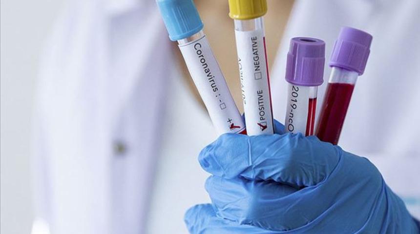 Van Sağlık Müdürü Doç. Dr. Sünnetçioğlu uyardı: Ev içi bulaş arttı