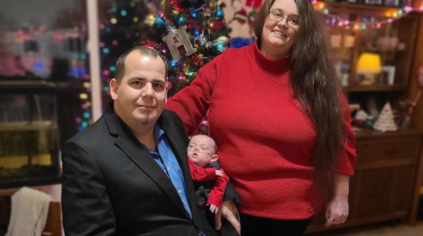 ABD’de 5 aylıkken doğan ve yaşamaz denilen bebek taburcu oldu