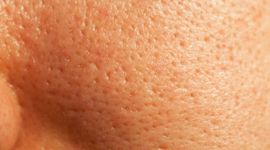 Gözenek sıkılaştırıcı yöntemleri işin uzmanlarından öğrendik: Siyah noktalarınız varsa bunu asla kullanmayın