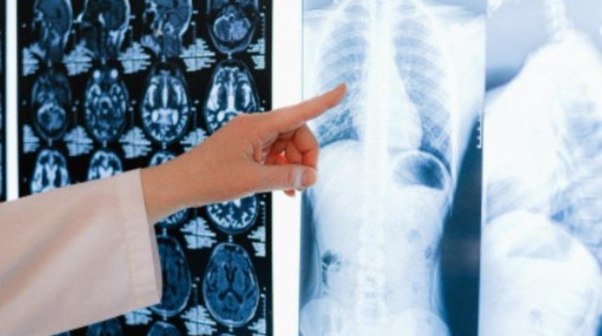 Akalazya hastalığı nasıl bir hastalıktır? Belirtileri nelerdir?