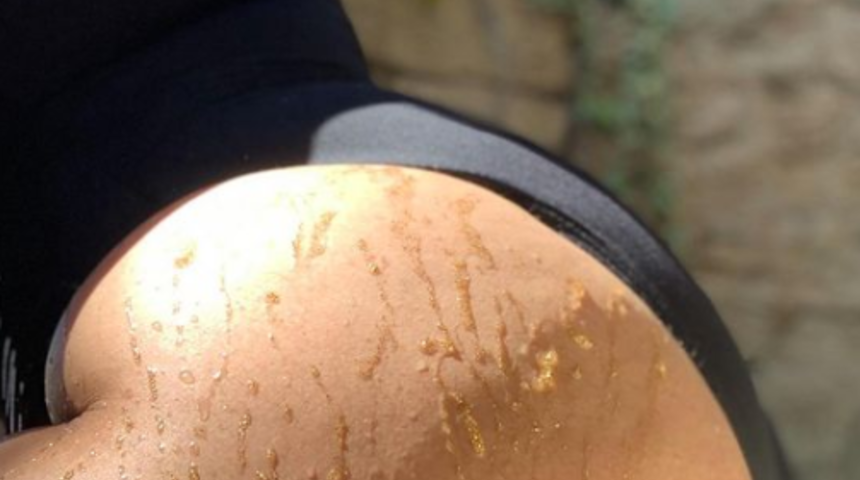 Demi Lovato yeme bozukluğunu yendi, v&uuml;cut &ccedil;atlaklarını sergiledi