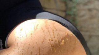 Demi Lovato yeme bozukluğunu yendi, vücut çatlaklarını sergiledi