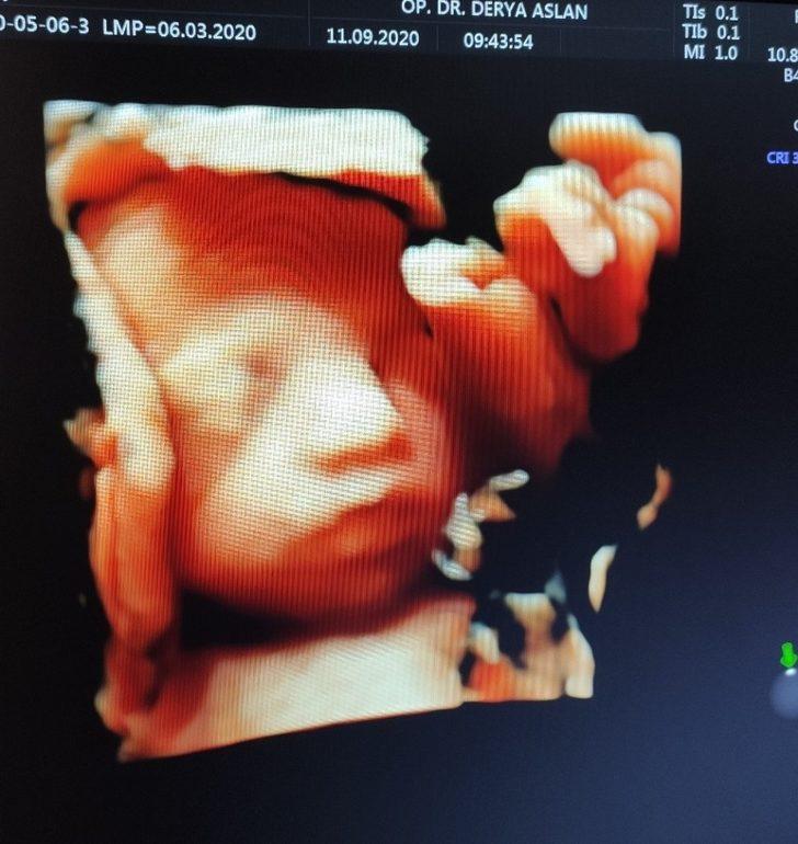 Kadın Doğum Uzmanı Dr. Aslan; "Pandemi sürecinde anne adayları kendilerine daha çok özen göstermeli" G5