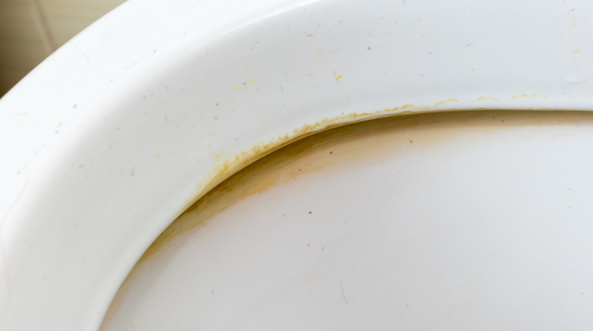 Tuvaletteki sarı lekeleri &ccedil;ıkarıyor, ayna gibi yapıyor!