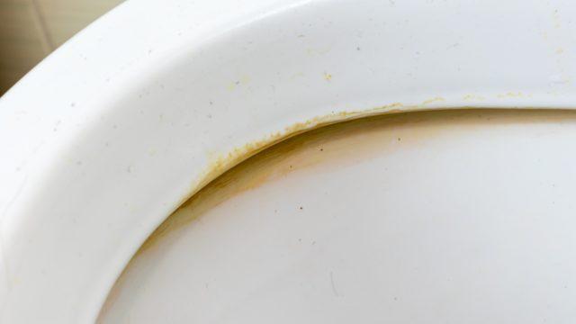 Tuvaletteki sarı lekeleri çıkarıyor, ayna gibi yapıyor!