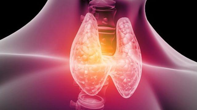 Graves hastalığı nedir, belirtileri nasıl ortaya çıkar?