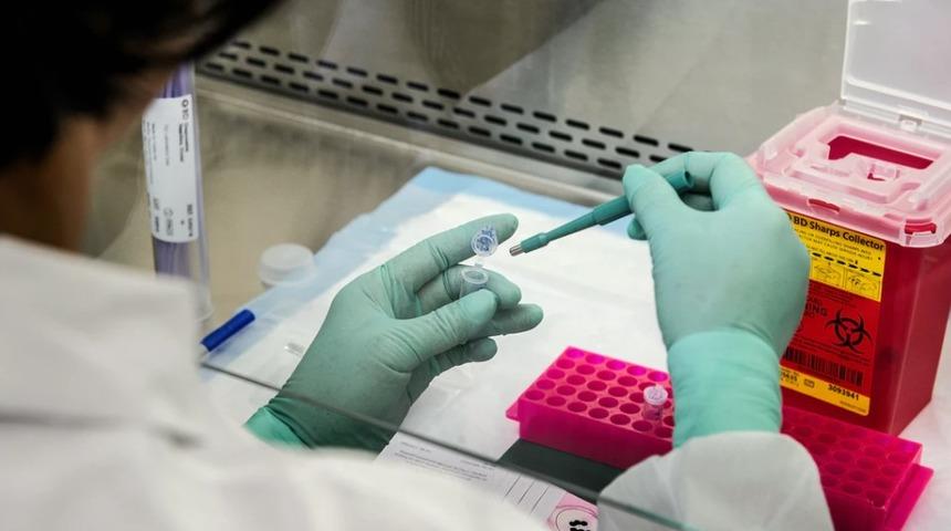 Pap smear testi nedir? Pap smear testi sonucunuz size ne söyler?