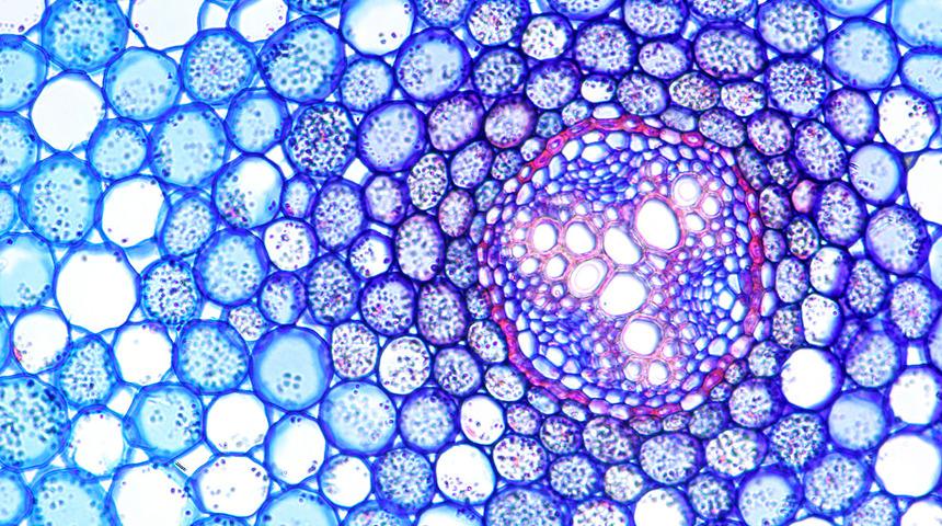 Sitoplazma transferi ne anlama gelir? Transfer nasıl yapılır? 