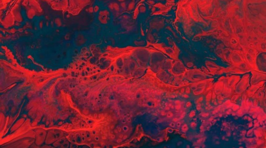 Buerger hastalığı nedir, görülebilecek belirtileri nelerdir?